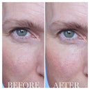 Lancome - Advanced Genifique Eye Cream 15ml XDaySale