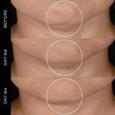 Lancôme - Renergie HPN-300 Peptide Cream Refill 50ml XDaySale